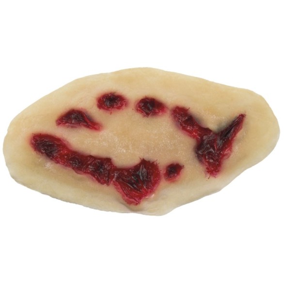 Aplicação FX Dentada Ferida