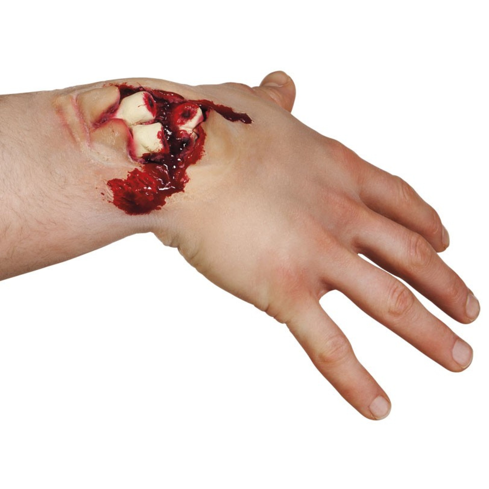 Aplicação FX Fractura Exposta