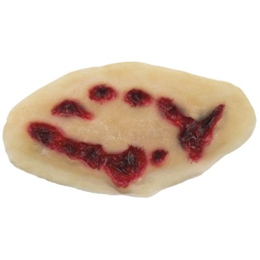 Aplicação FX Dentada Ferida Aplicação FX Dentada Ferida