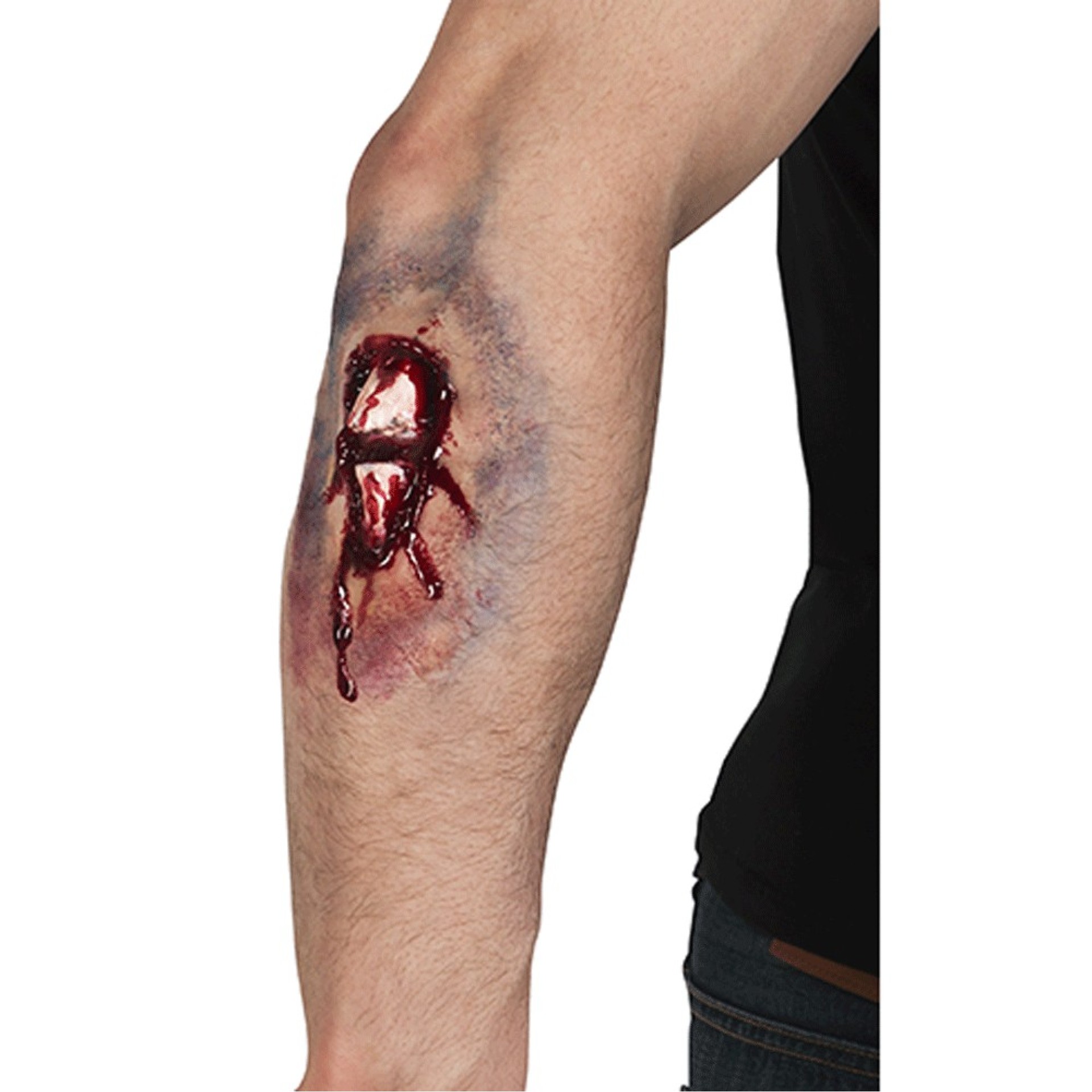 Aplicação FX Osso de Fora