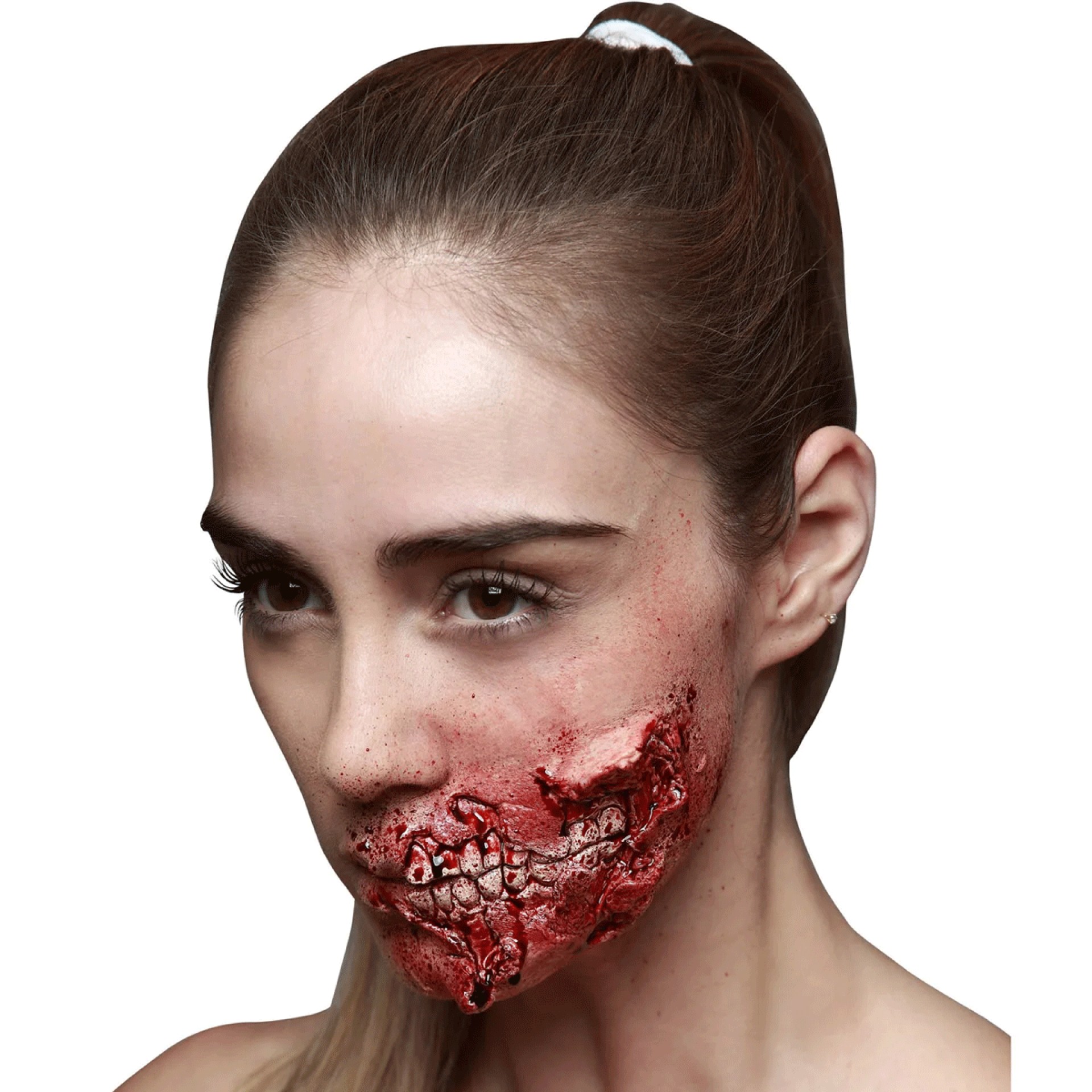 Aplicação FX Boca Em Decomposição