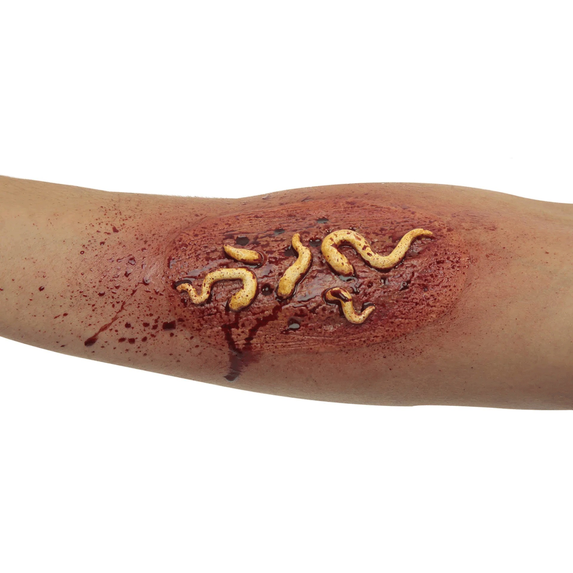 Aplicação FX Larvas no Braço