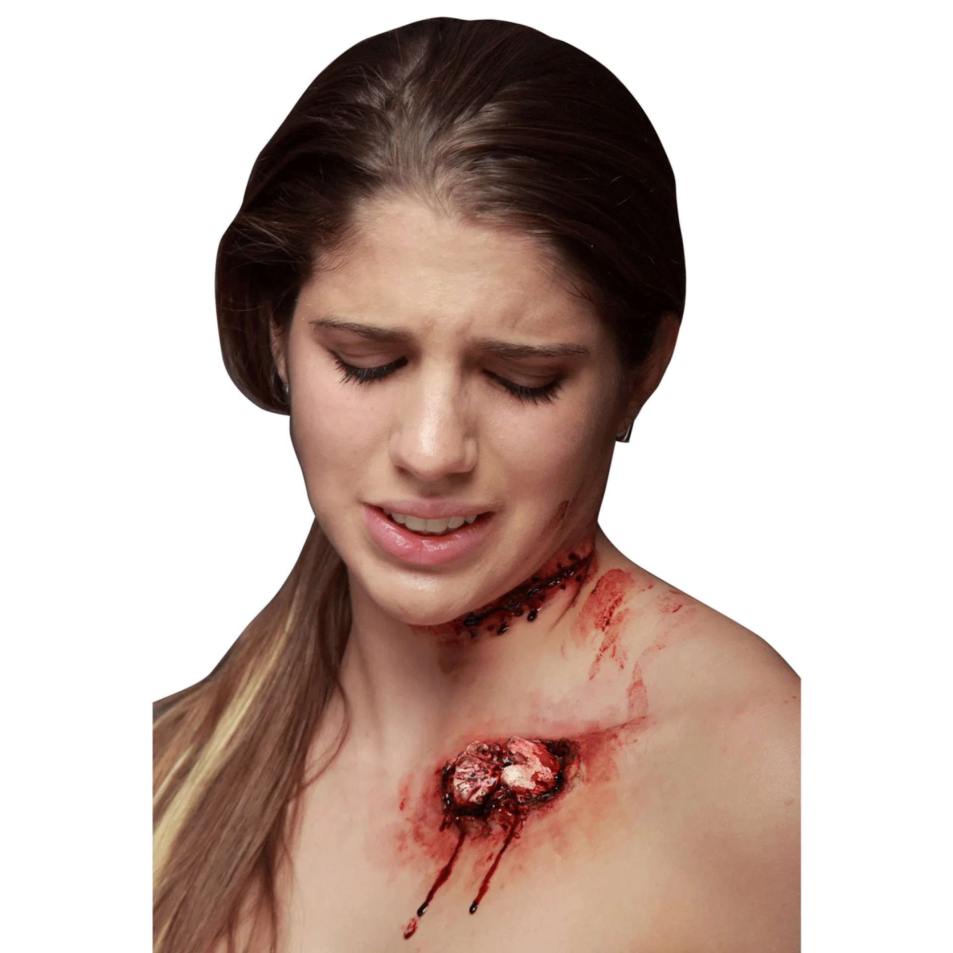 Aplicação FX Osso Exposto