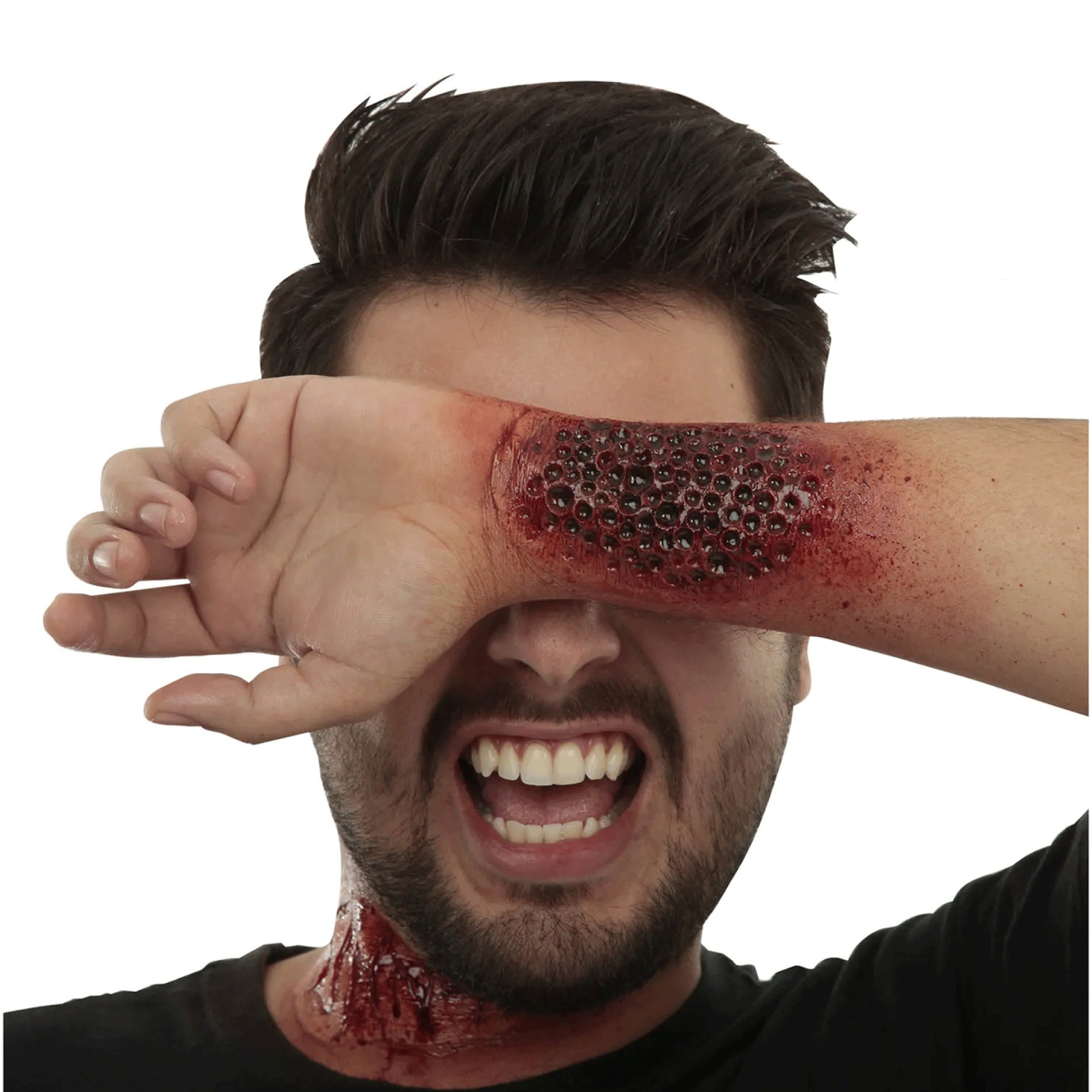 Aplicação FX Queimadura Acido