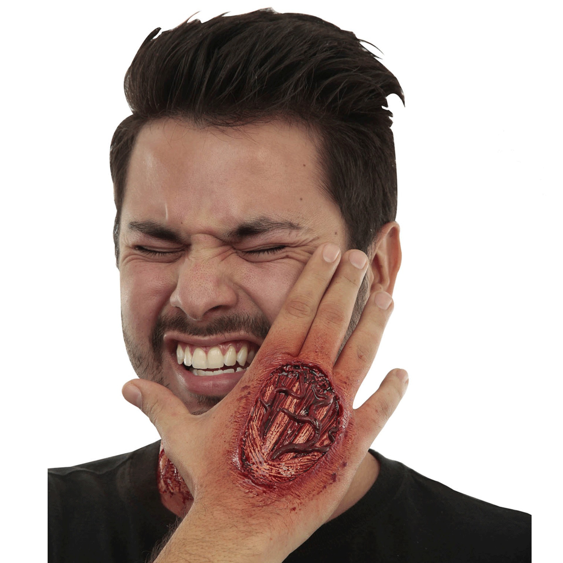 Aplicação FX Queimadura Mão